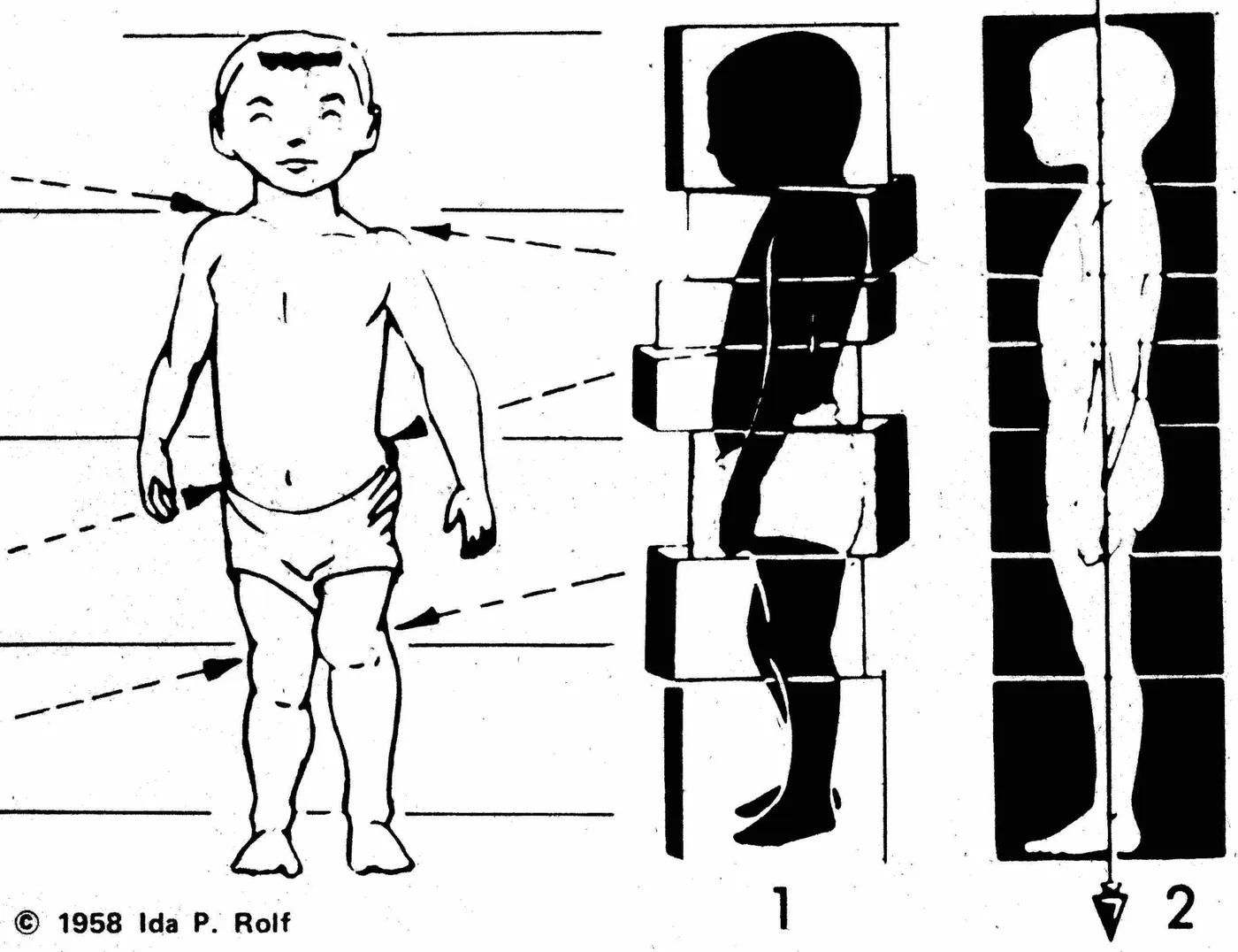 Ilustracja dr Idy P. Rolf z 1958 roku: sylwetka dziecka przed i po Integracji Strukturalnej, z linią grawitacji